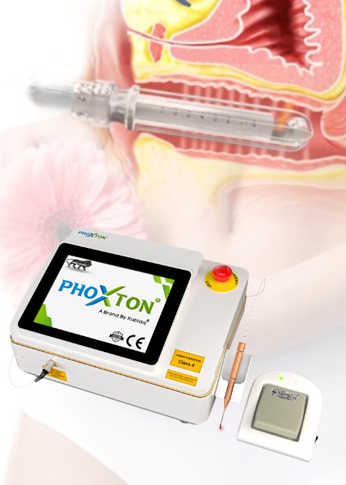 Laser Machine for Cosmetic Gynecology Treatment