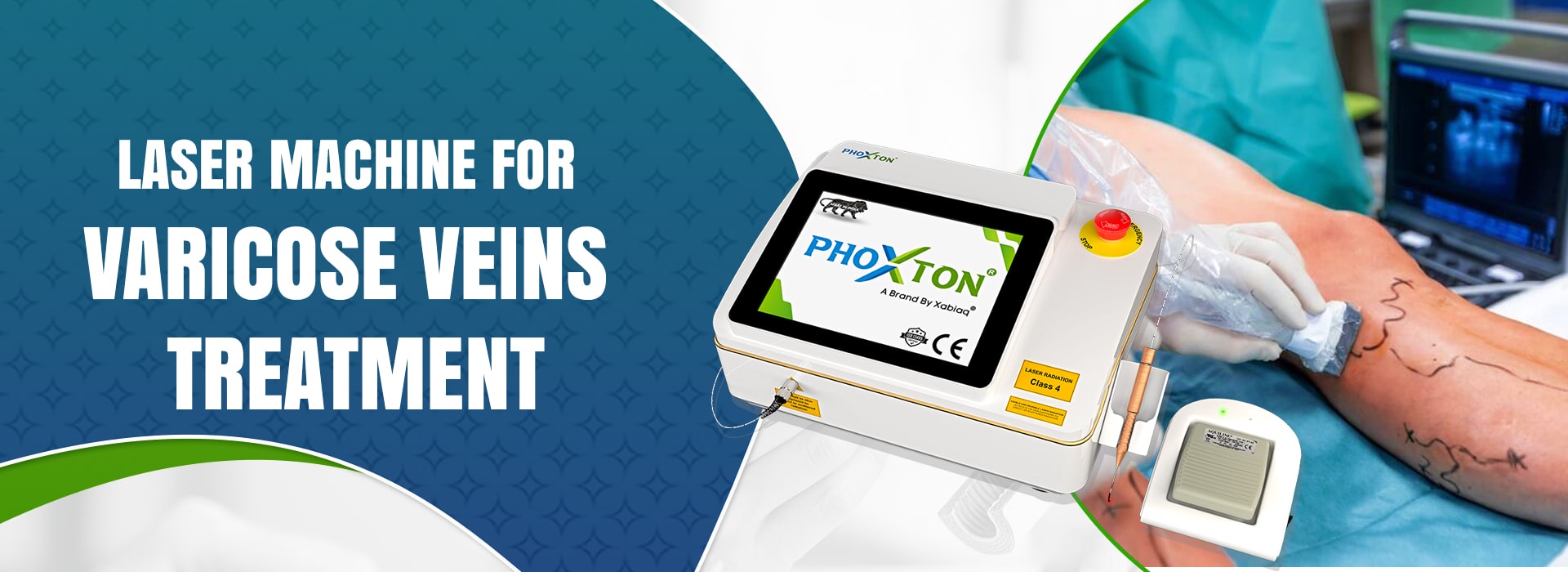 Laser Machine for Varicose Veins Treatment in Ahmedabad Laser Machine for Varicose Veins Treatment in Ahmedabad