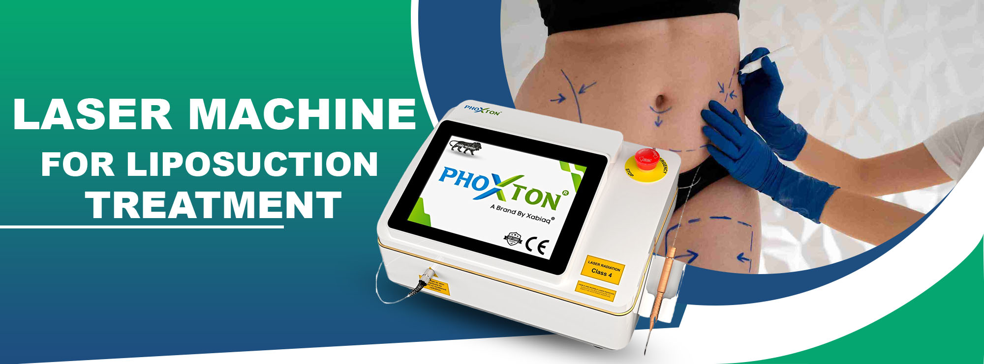 Laser Machine for Liposuction Treatment in Ahmedabad